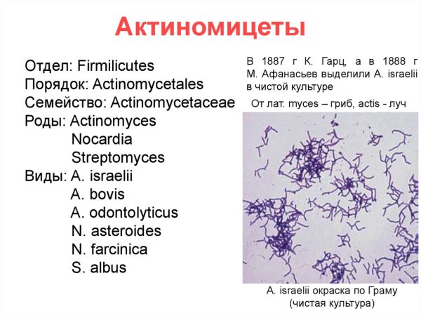Микрофлора полости рта актиномицеты