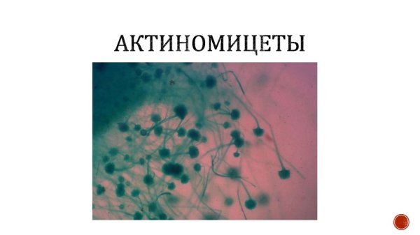 Нитевидные бактерии актиномицеты