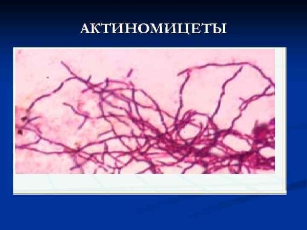 Мицелий актиномицетов микроскопия