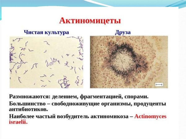 Актиномицеты схема