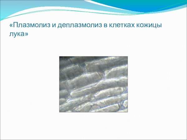Плазмолиз в клетках кожицы лука рисунок