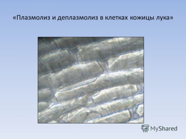 Плазмолизированные клетки чешуи лука