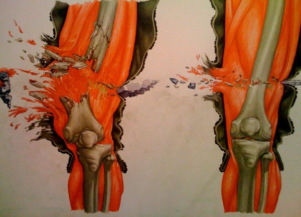 Разрывные пули дум-дум