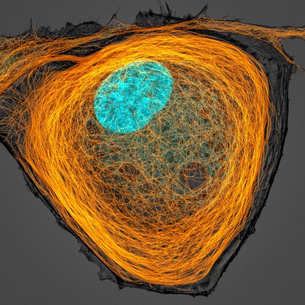 Микрофотографии Nikon small World 2017