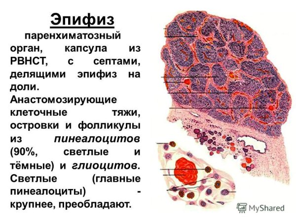 Эпифиз гистология препарат