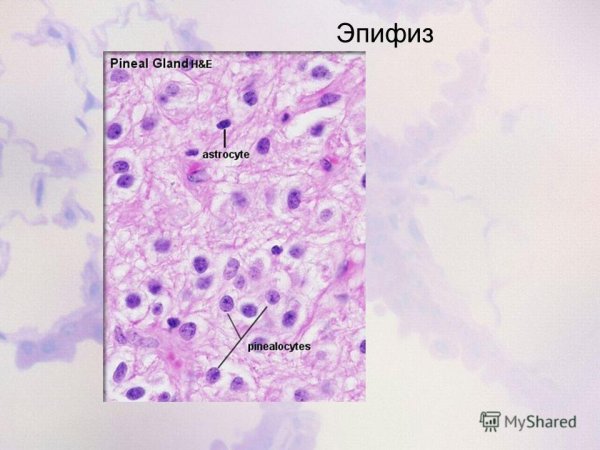 Пинеалоциты эпифиза