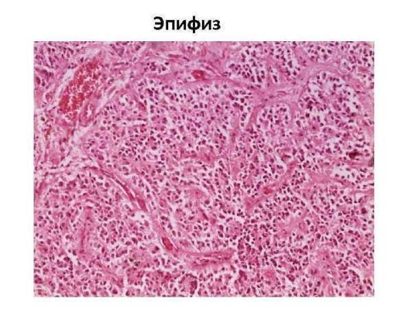 Эпифиз гистология препарат