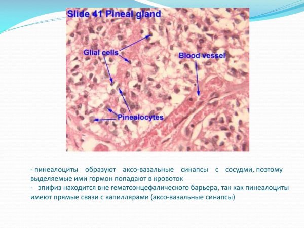 Эпифиз строение гистология