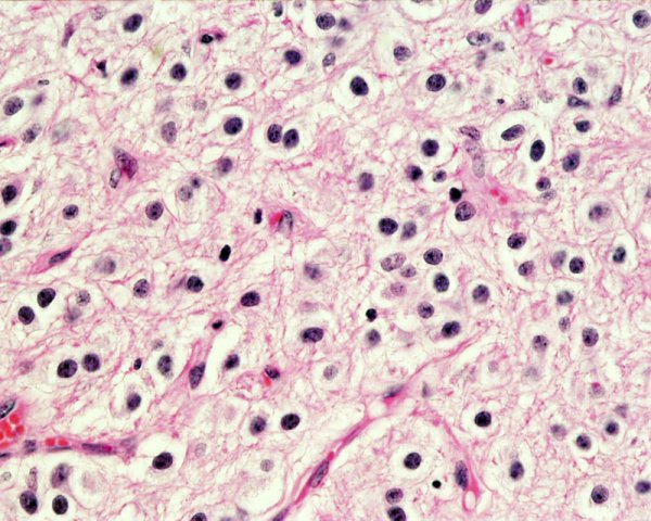 Эпифиз гистология