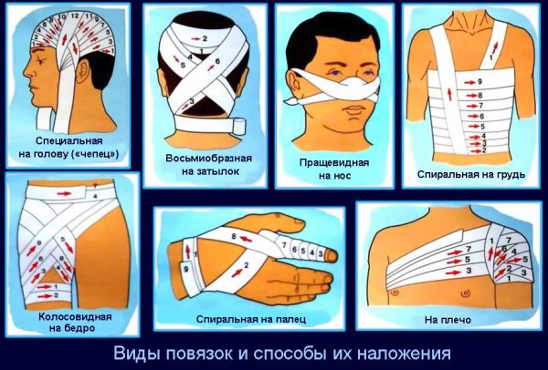 Десмургия алгоритм