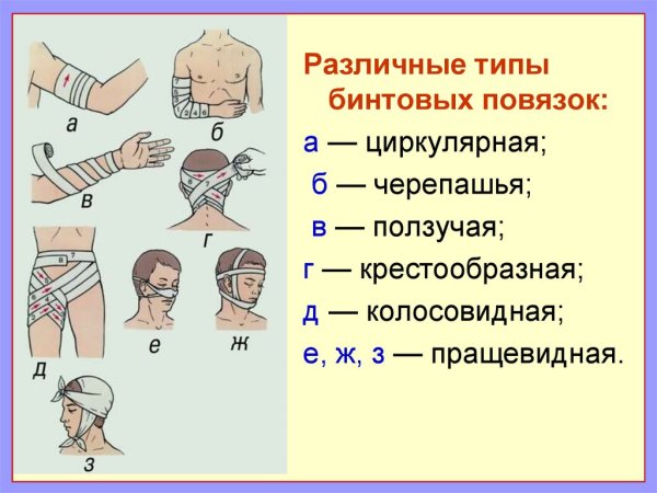 Эластичное бинтование лучезапястного сустава