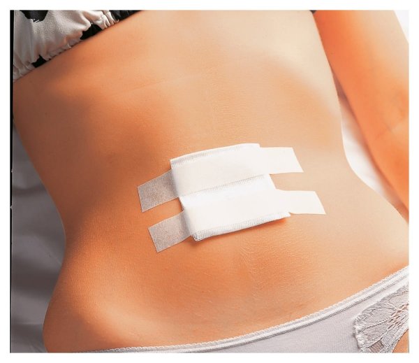 Лейкопластырь Adhesive wound Dressing 6*7
