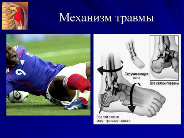 Травматолог