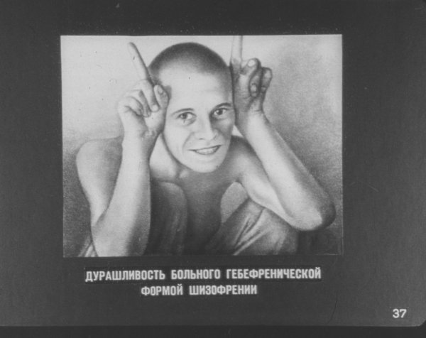Лицо больного шизофренией