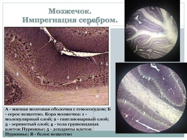 Мозжечок гистология препарат