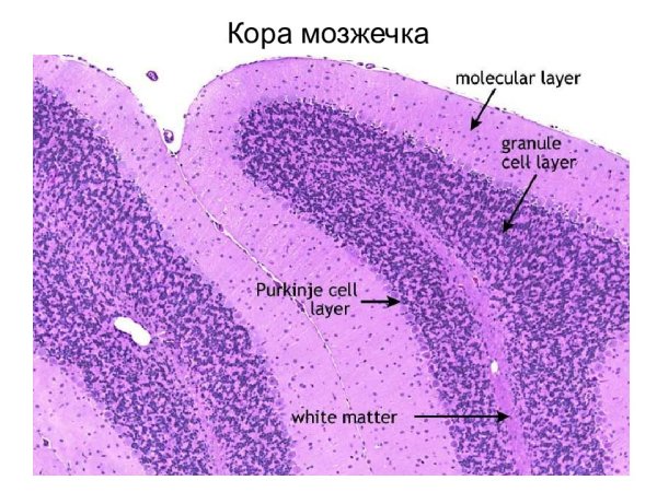 Мягкая мозговая оболочка мозжечка гистология