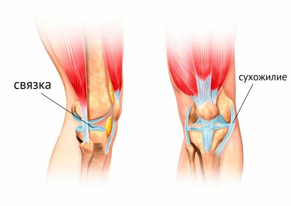 Осгуд Шляттера болезнь