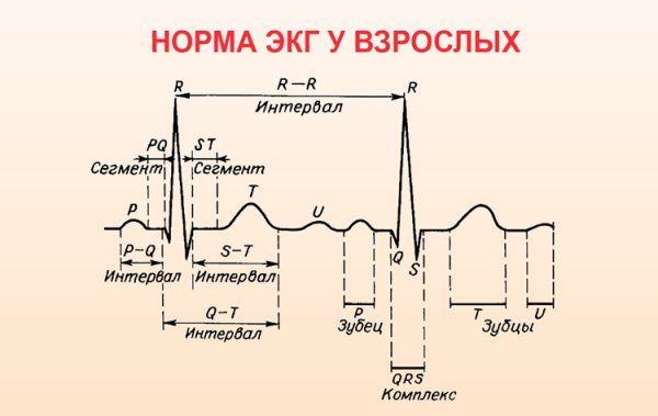 Анализ QRS ЭКГ