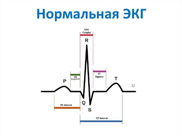 Расшифровка ЭКГ норма QRS