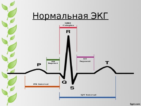 ЭКГ патологии расшифровка таблица
