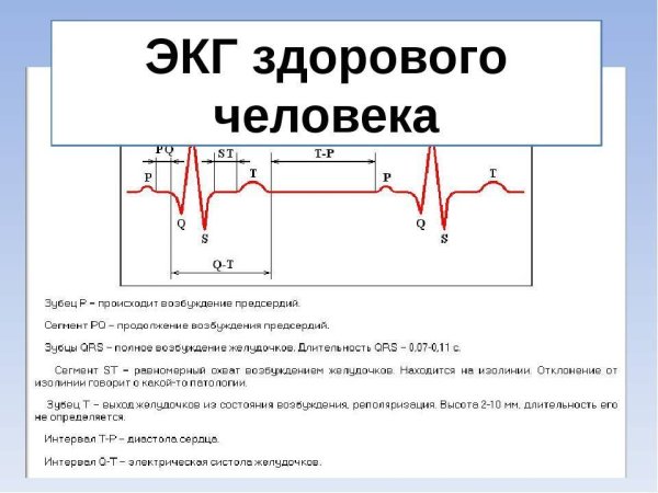 Нормальные Результаты ЭКГ