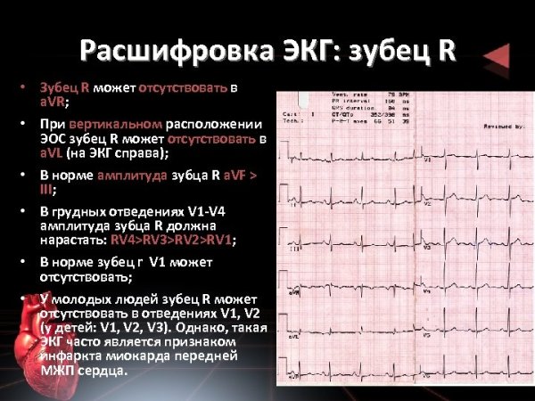QRST на ЭКГ норма