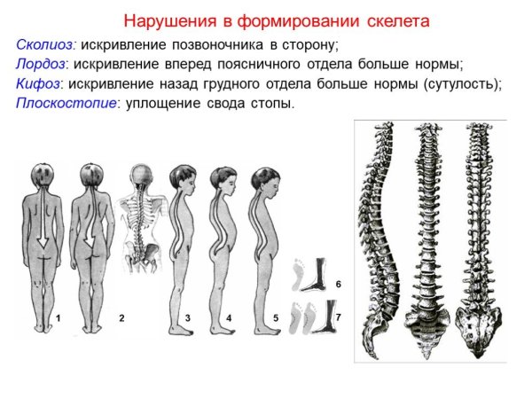 Скелет туловища человека лордоз кифоз