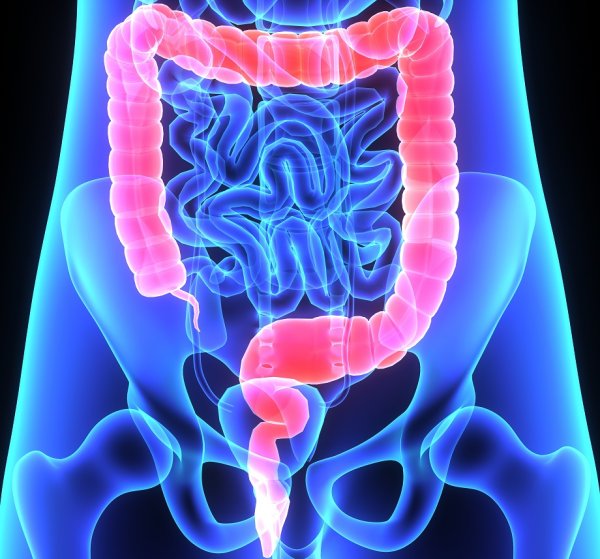 Анатомия толстой кишки долихосигма