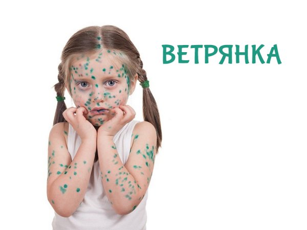 Циндол при ветрянке