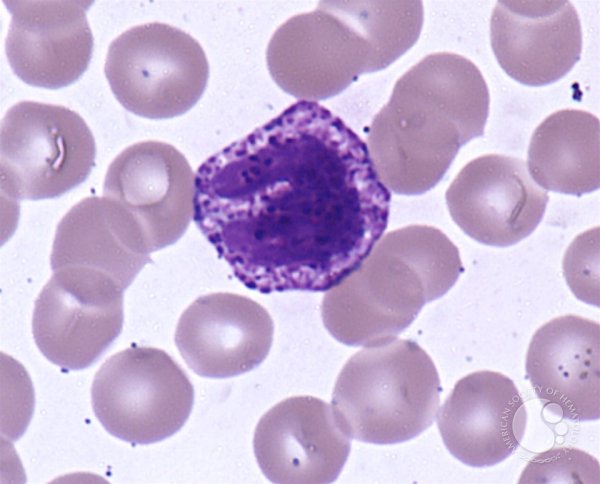 Базофильный гранулоцит микрофотография