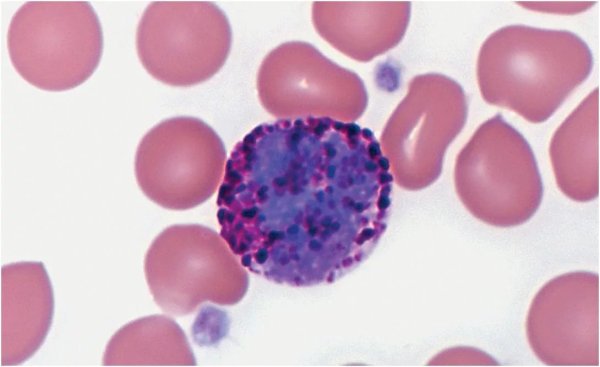 Базофилы в мазке крови