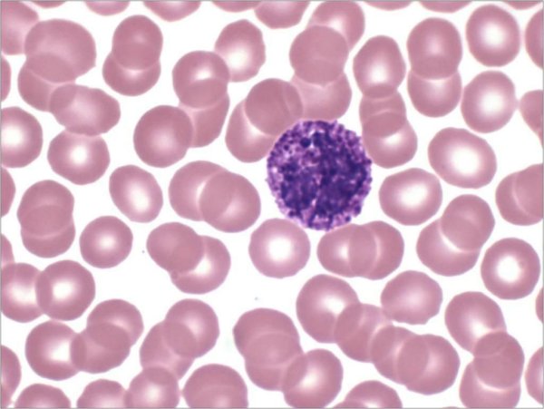 Базофильный гранулоцит гистология