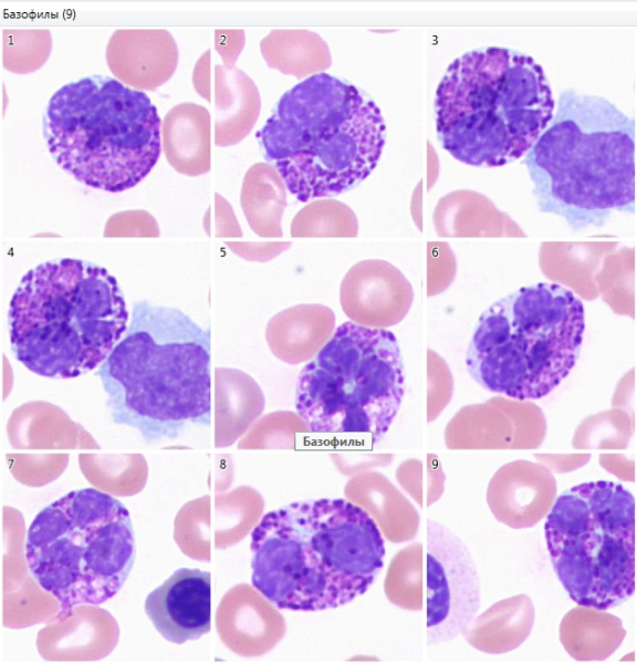 Базофилы микроскопия