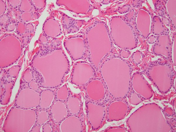 Клетки слизистой оболочки желудка секретируют