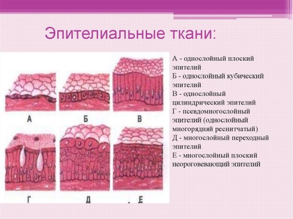 Тиреоидит Хашимото гистология