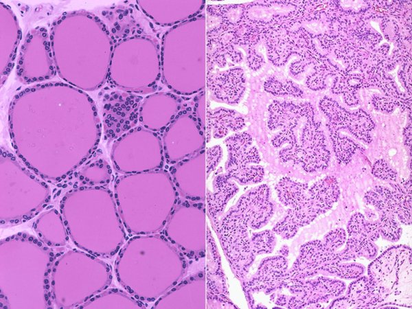 Схема строения эпителиальной ткани