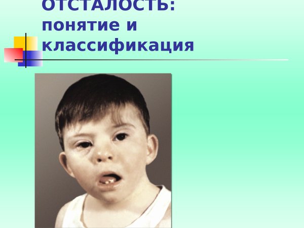 Умственная отсталость