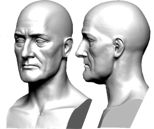 Формы головы у новорожденных долихоцефалия