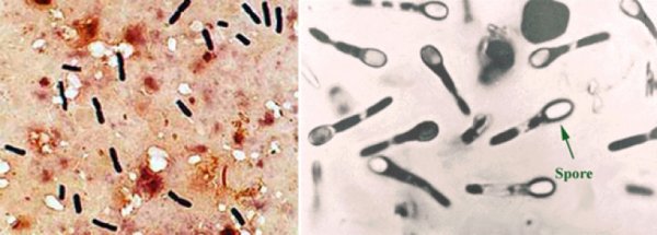 Бактерией Clostridium tetani