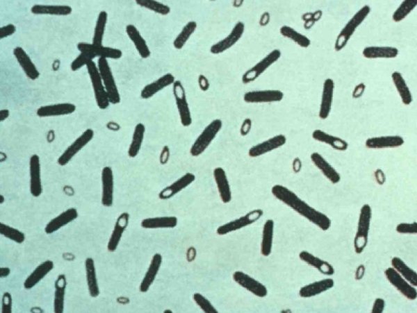 Клостридии ботулизма ( Clostridium botulinum ) ботулизм