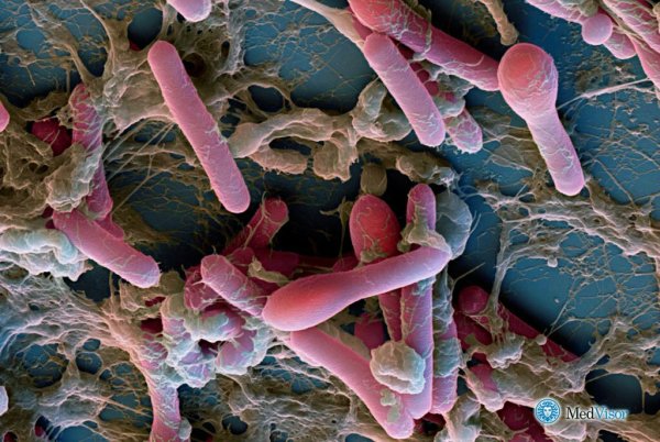 Clostridium botulinum микроскоп