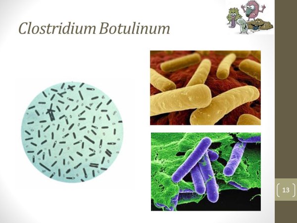 Клостридии ботулизма ( Clostridium botulinum ) ботулизм