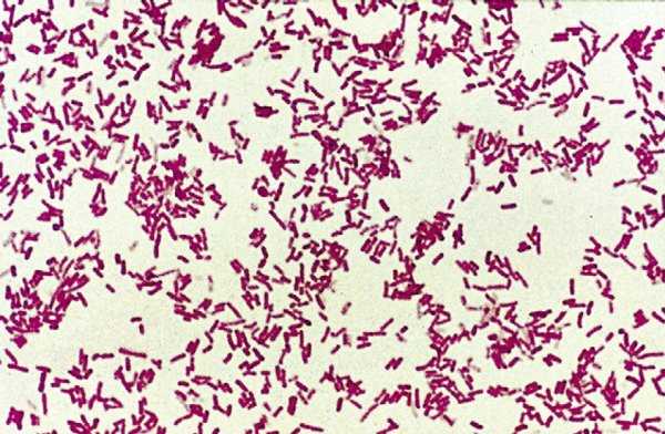 Clostridium tetani микроскоп