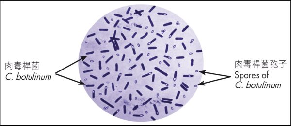 Clostridium botulinum окраска