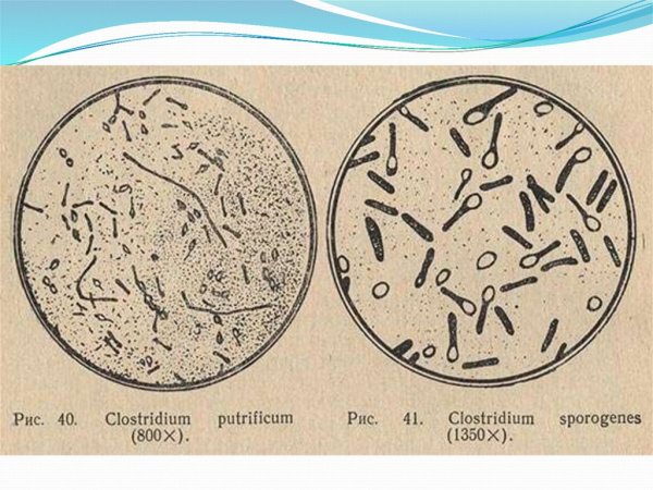 Clostridium putrificum