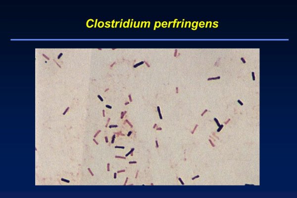 Клостридии ботулизма ( Clostridium botulinum ) ботулизм