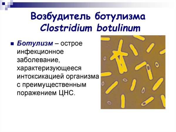 Токсины возбудителя ботулизма