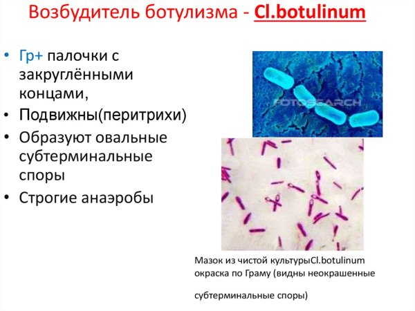 Clostridium tetani окраска Граму