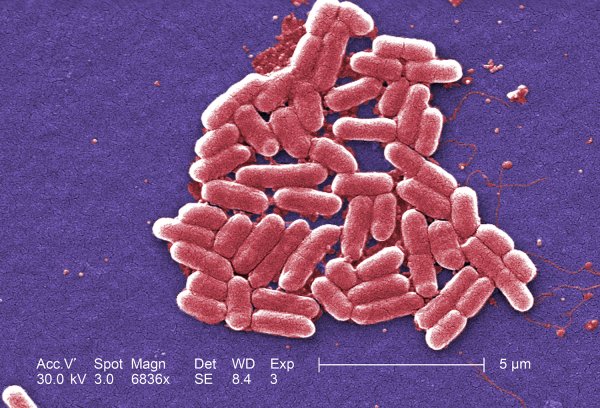 Кишечная палочка Escherichia coli