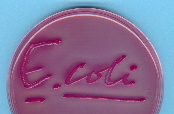 Бактерия Escherichia coli